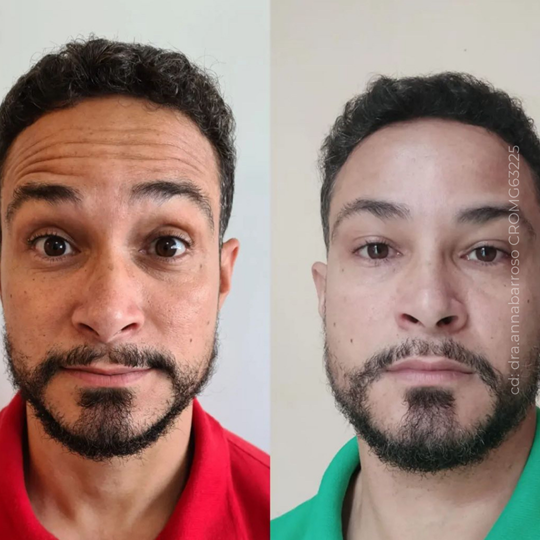 Antes e Depois 25